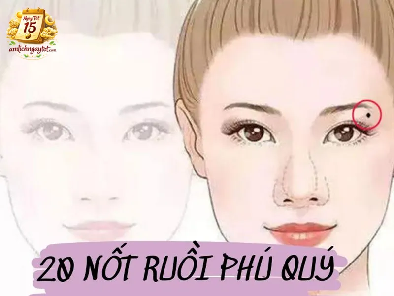 Phân loại nốt ruồi theo mệnh lý học