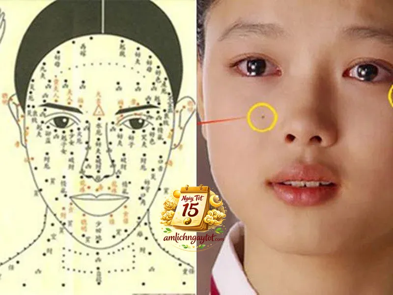 Nốt ruồi trên khuôn mặt