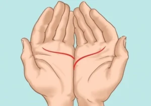 Giải mã chỉ tay đứt đoạn có sao không?