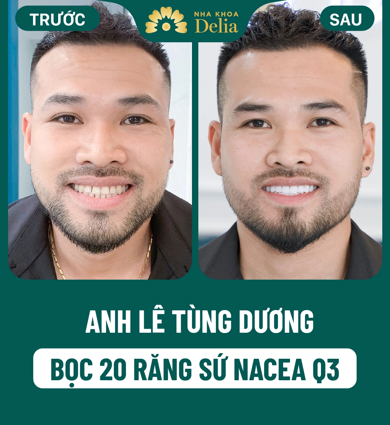 Diện mạo tươi tắn và tự tin khi thay đổi những nét tướng xấu