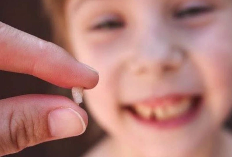 Giấc mơ thấy răng bị gãy, rụng là một trong những giấc mơ khá phổ biến