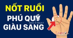 giai-ma-y-nghia-17-vi-tri-not-ruoi-trong-long-ban-tay-chi-ti_102