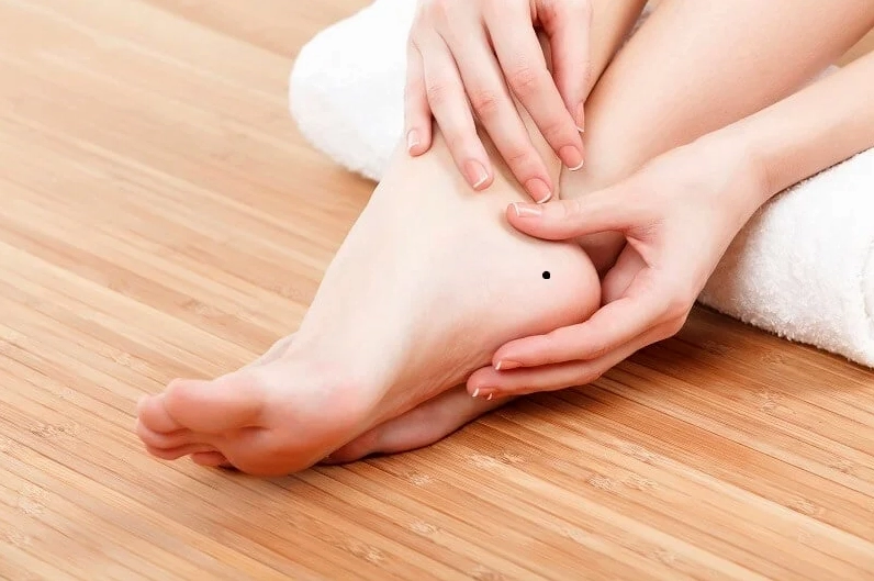 Nốt ruồi ở bàn chân cần được theo dõi về mặt y tế