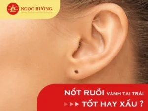 not-ruoi-o-vanh-tai-bao-hieu-dieu-gi-giai-ma-tuong-so-2026_811