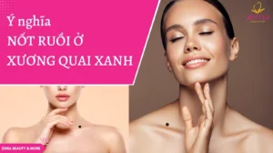 not-ruoi-o-xuong-quai-xanh-giai-ma-van-menh-phu-quy-hay-diem_330