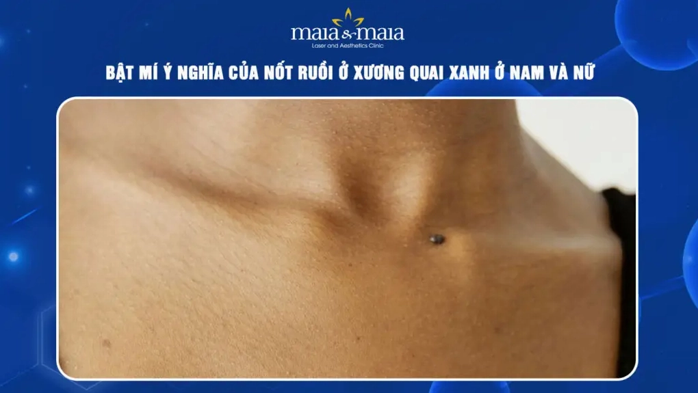 Nốt ruồi ở xương quai xanh là một nét tướng ẩn chứa nhiều may mắn